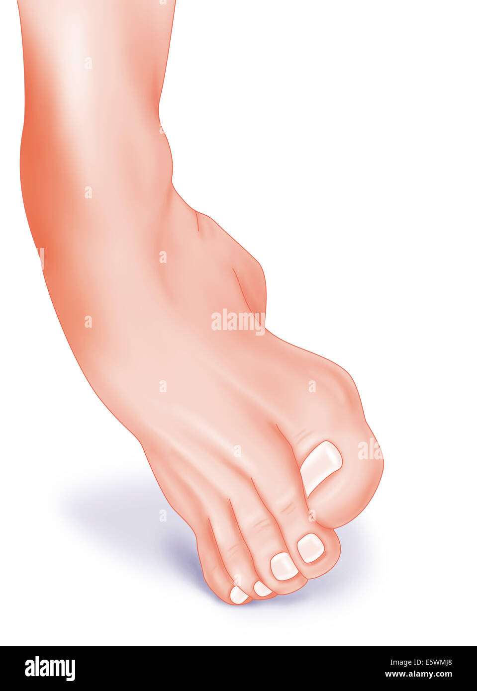 Sprained ankle hi-res stock photography and images - Alamy Sprained ankle hi-res stock photography and images - Alamy