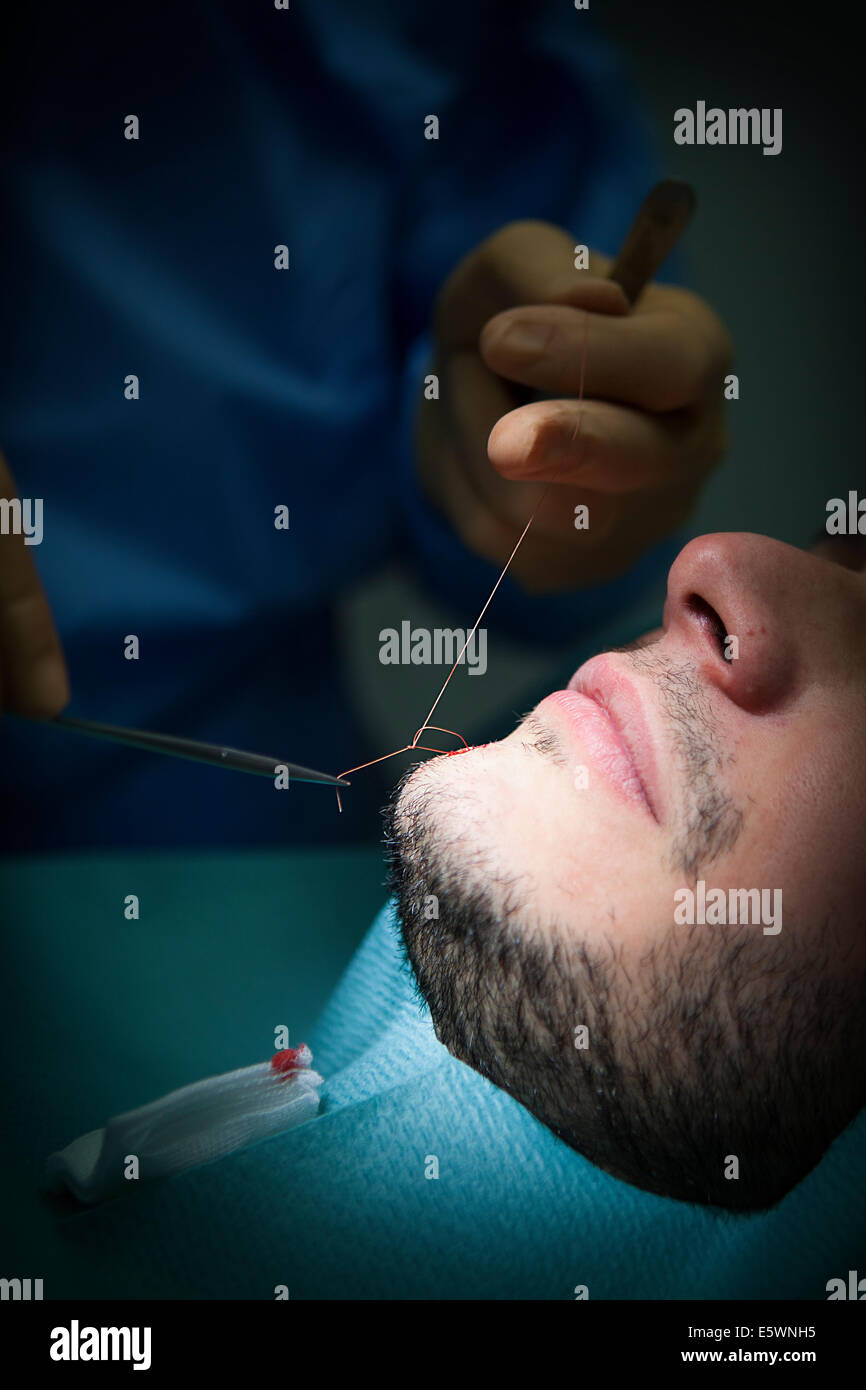 Dermatologic surgery Stock Photo