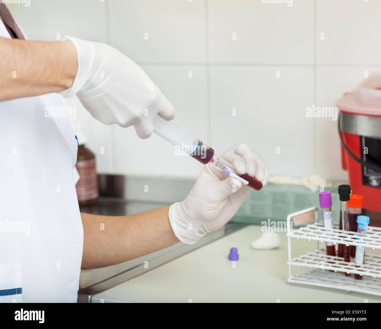 Technician Filling Blood Sample In Test Tube Stock Photo