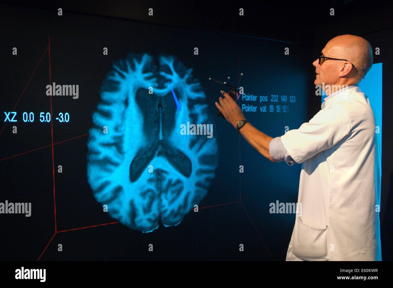 Medical specialist pointing at the area where the pineal gland is located on a virtual 3D image of a brain Stock Photo