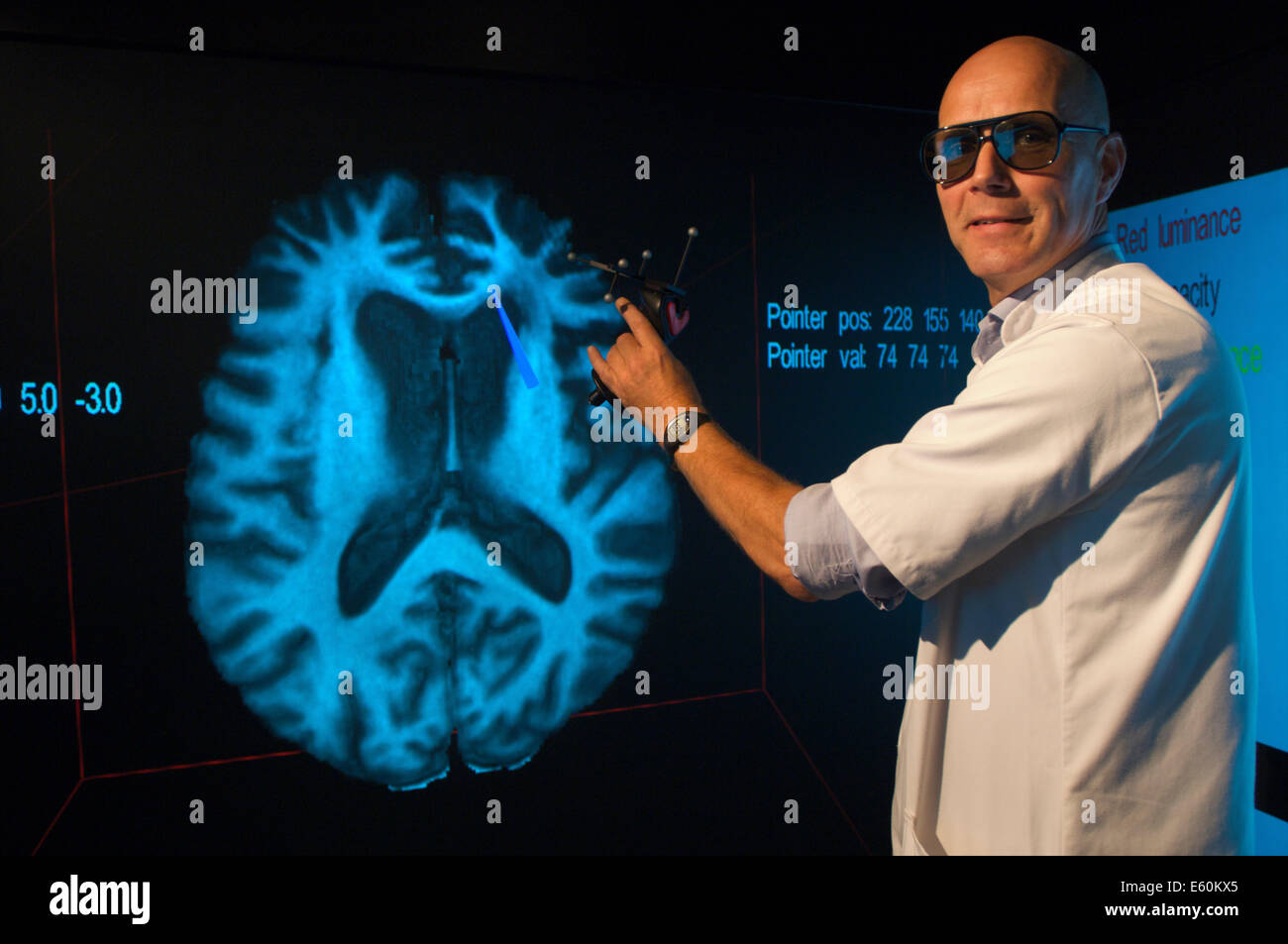 Portrait of a medical specialist pointing at the area where Alzheimers disease is located on a virtual 3D image of the brain Stock Photo