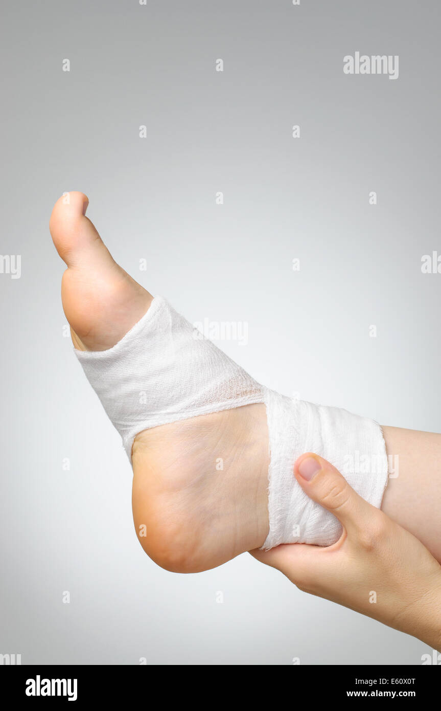 Injured foot with white gauze bandage Stock Photo Alamy