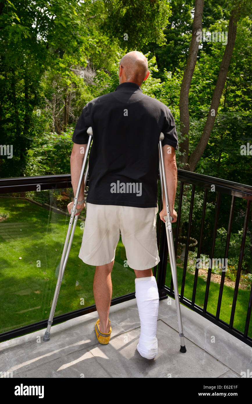 Injured man with leg in a cast and crutches recovering from injuries on a balcony looking at a forest Stock Photo