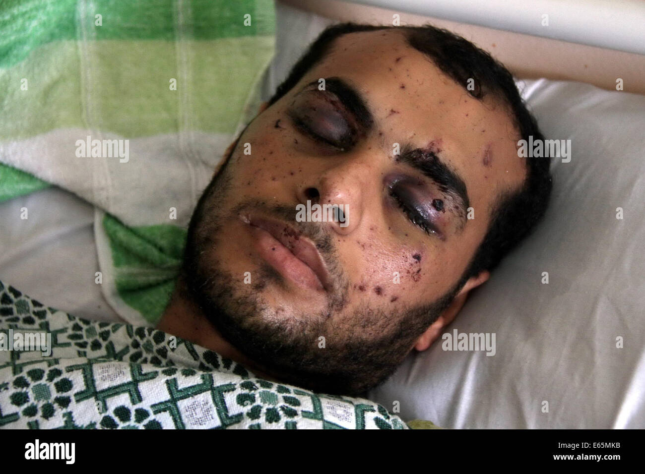 Cairo, Egypt. 15th Aug, 2014. A Palestinian man, who medics said was wounded during the Israeli offensive, lies on a bed at the Red Crescent hospital, Cairo, Egypt on August 15, 2014. Two successive truces since Monday, expected to last through August 19, have largely quieted the guns, after 1,980 Palestinians, most of them civilians, 64 Israeli soldiers and three civilians in Israel were killed Credit:  Mohammed Bendari/APA Images/ZUMA Wire/Alamy Live News Stock Photo