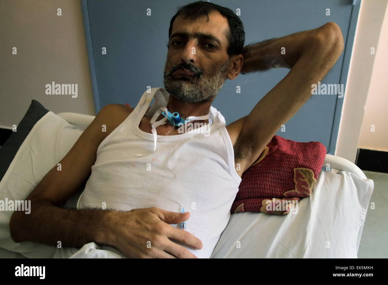 Cairo, Egypt. 15th Aug, 2014. A Palestinian man, who medics said was wounded during the Israeli offensive, lies on a bed at the Red Crescent hospital, Cairo, Egypt on August 15, 2014. Two successive truces since Monday, expected to last through August 19, have largely quieted the guns, after 1,980 Palestinians, most of them civilians, 64 Israeli soldiers and three civilians in Israel were killed Credit:  Mohammed Bendari/APA Images/ZUMA Wire/Alamy Live News Stock Photo