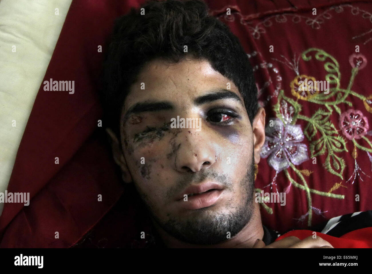 Cairo, Egypt. 15th Aug, 2014. A Palestinian man, who medics said was wounded during the Israeli offensive, lies on a bed at the Red Crescent hospital, Cairo, Egypt on August 15, 2014. Two successive truces since Monday, expected to last through August 19, have largely quieted the guns, after 1,980 Palestinians, most of them civilians, 64 Israeli soldiers and three civilians in Israel were killed Credit:  Mohammed Bendari/APA Images/ZUMA Wire/Alamy Live News Stock Photo