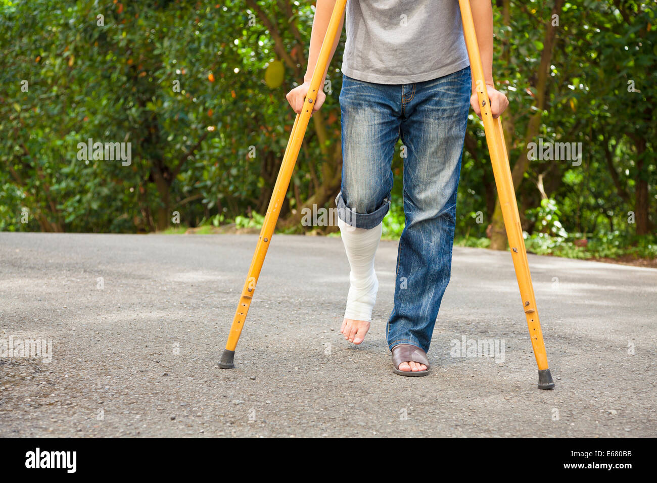 Broken leg crutches hires stock photography and images Alamy
