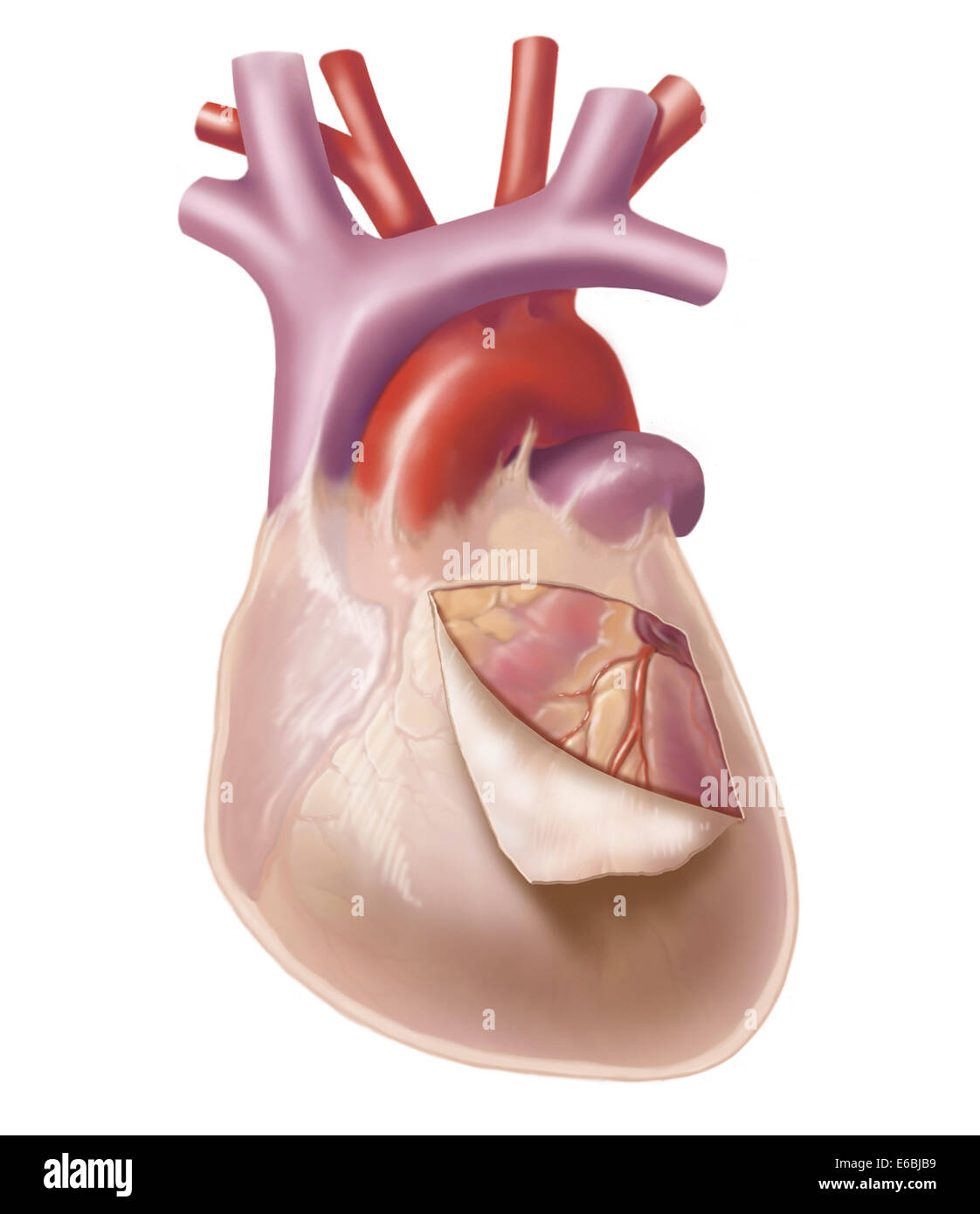Heart with pericadium pulled back exposing heart muscle. Stock Photo