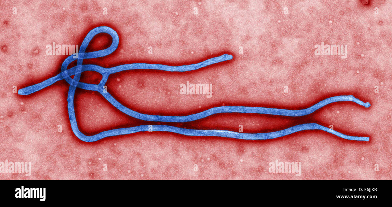 Microscopic view of the Ebola virus. This colorized transmission electron micrograph view of the ultrastructural morphology displayed by an Ebola virus virion was captured by the CDC. Stock Photo