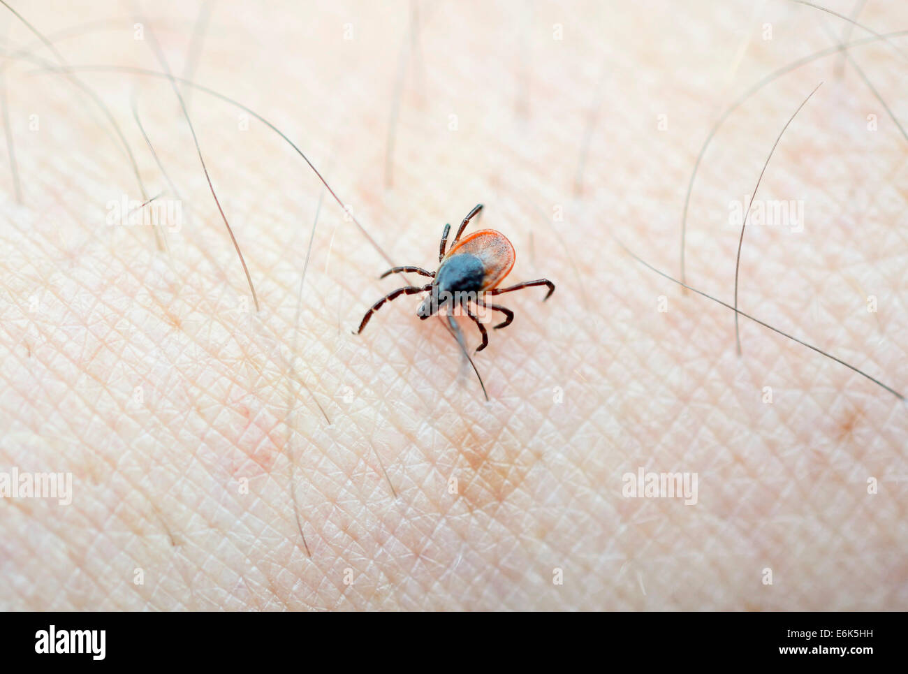 Castor Bean Tick (Ixodes ricinus) crawling on human skin Stock Photo