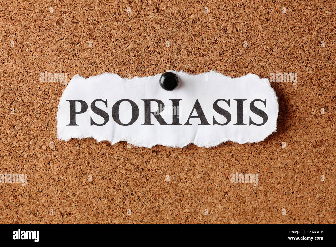 Torn piece of paper with the word 'Psoriasis' on cork board (bulletin board). Stock Photo