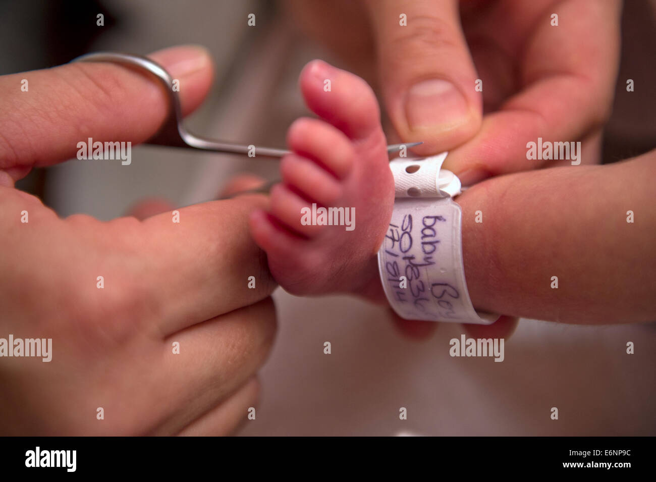 Removing a baby's hospital identification tag on arrival at home UK