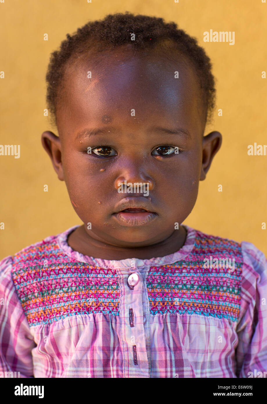 Mingi Baby Rescued In Omo Child Foundation, Jinka, Omo Valley, Ethiopia