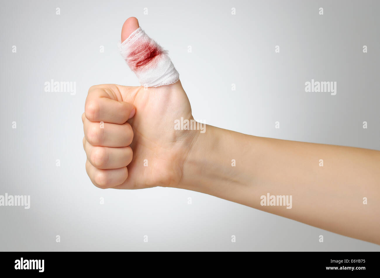 Injured finger with bloody gauze bandage Stock Photo Alamy