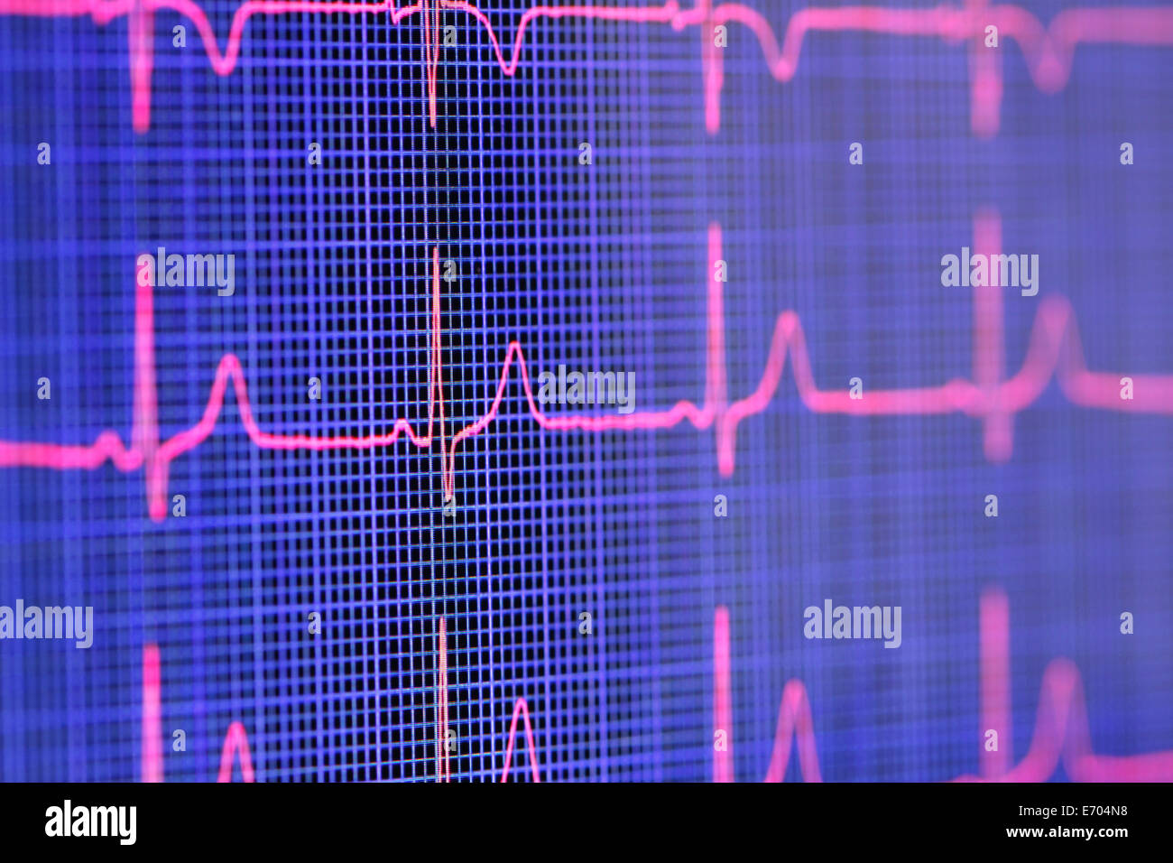 Tablet computer screen displaying an electrocardiogram Stock Photo