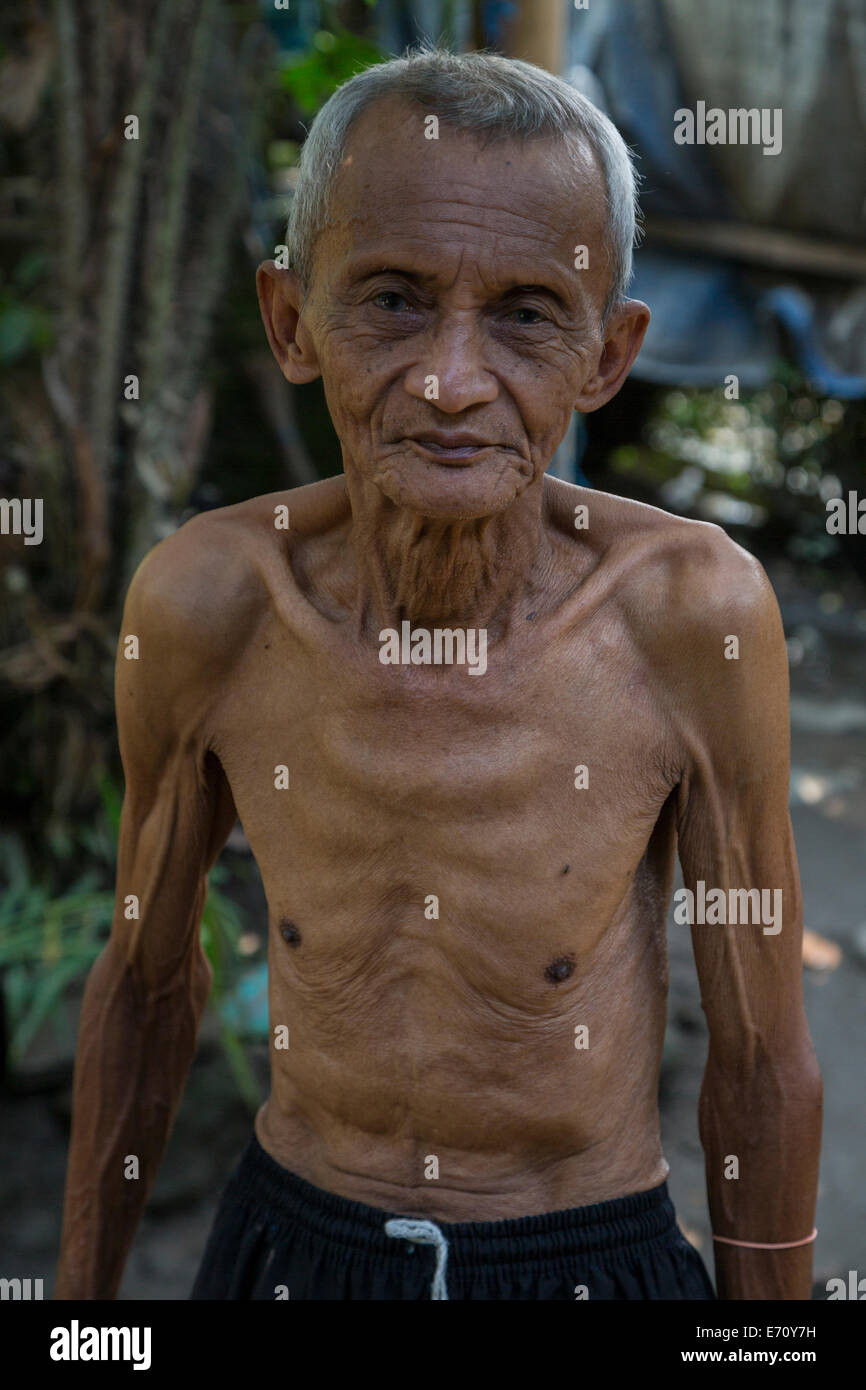Borobudur, Java, Indonesia.  Emaciated Indonesian Man. Stock Photo
