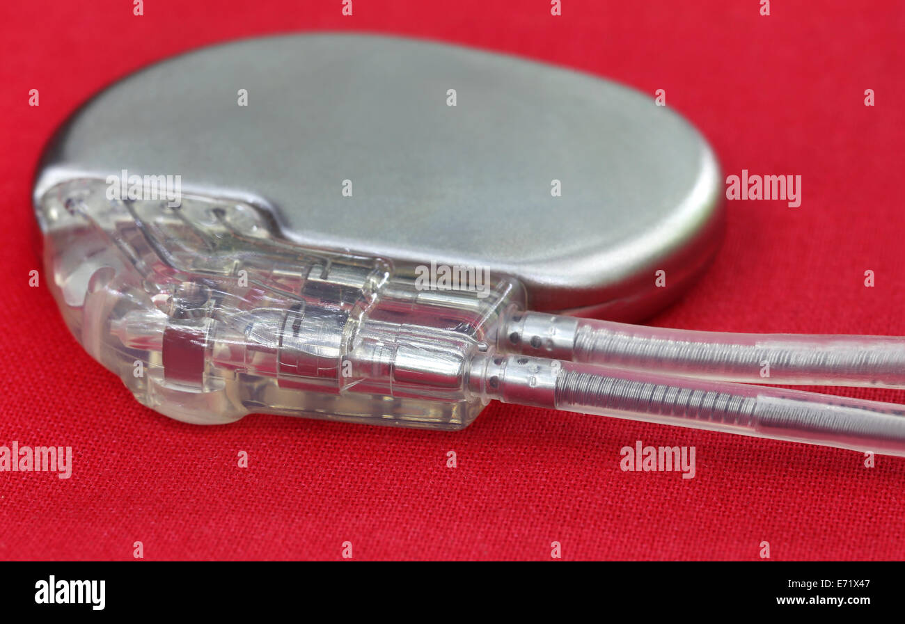 Close up of a Pacemaker with Electrical Leads Stock Photo Alamy
