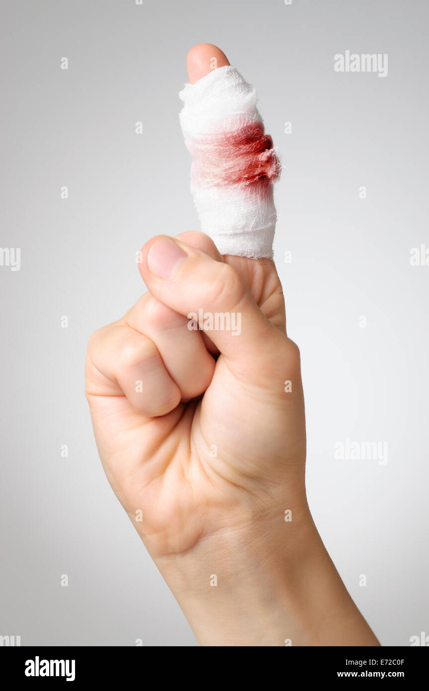 Injured finger with bloody gauze bandage Stock Photo Alamy
