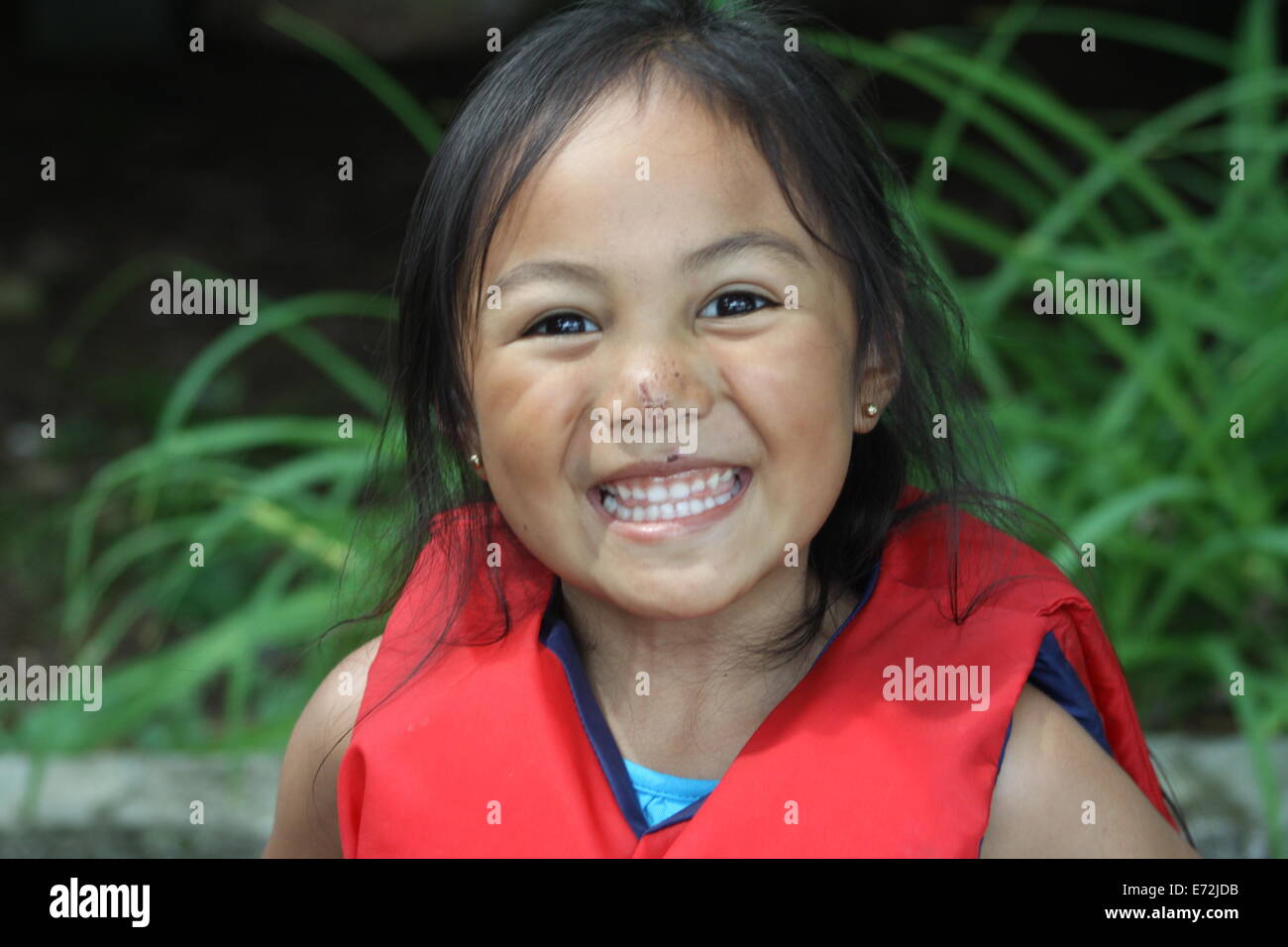 Young girl with scratches on her nose and lip from a fall, big grin ...