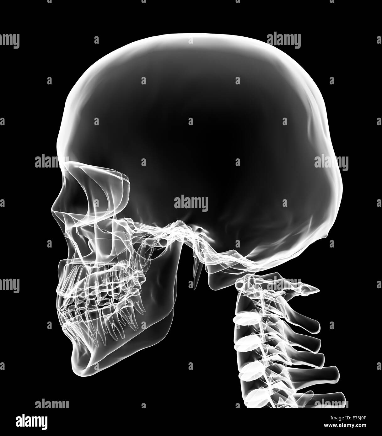 Xray head and neck in brightness white with black background Stock