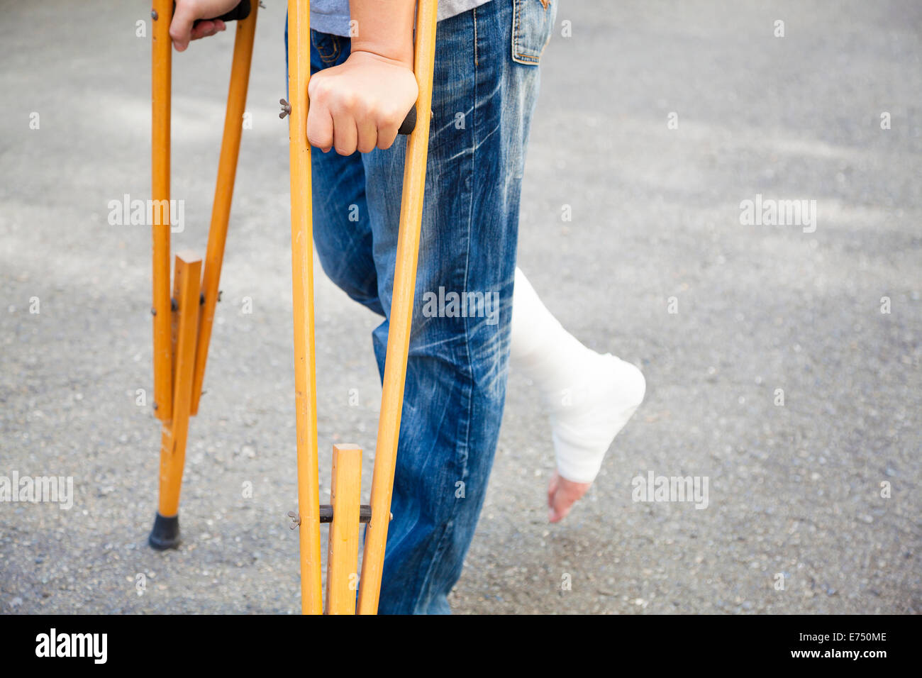 Man broken leg on crutches hires stock photography and images Alamy