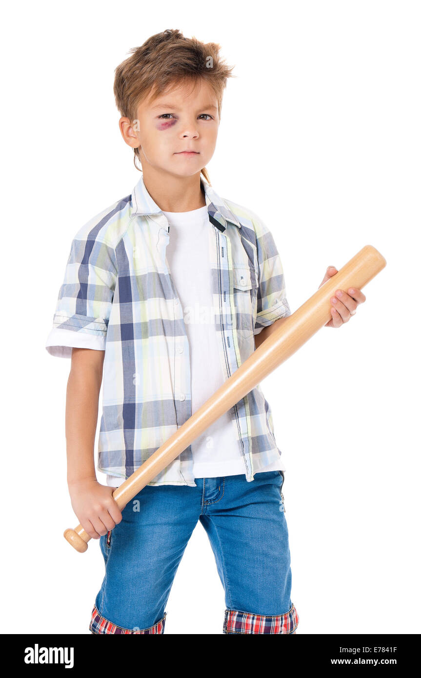 Boy with bruise Stock Photo