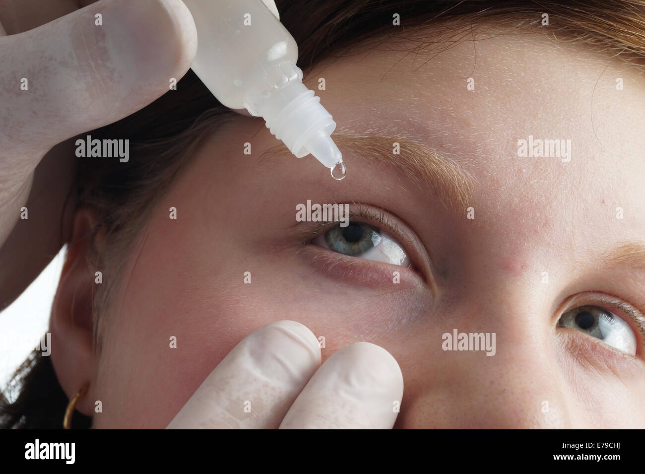 Nurse giving a child eye drops. Medical procedure Stock Photo Alamy