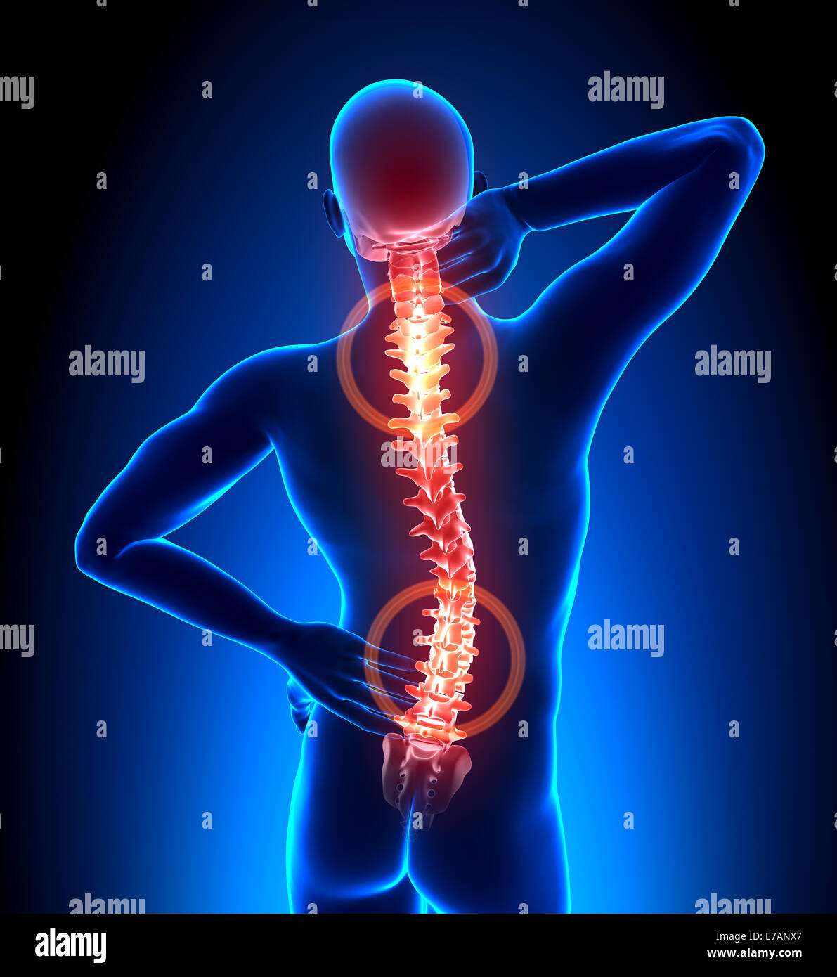 Male Hurt Backbone Vertebrae Pain Stock Photo Alamy