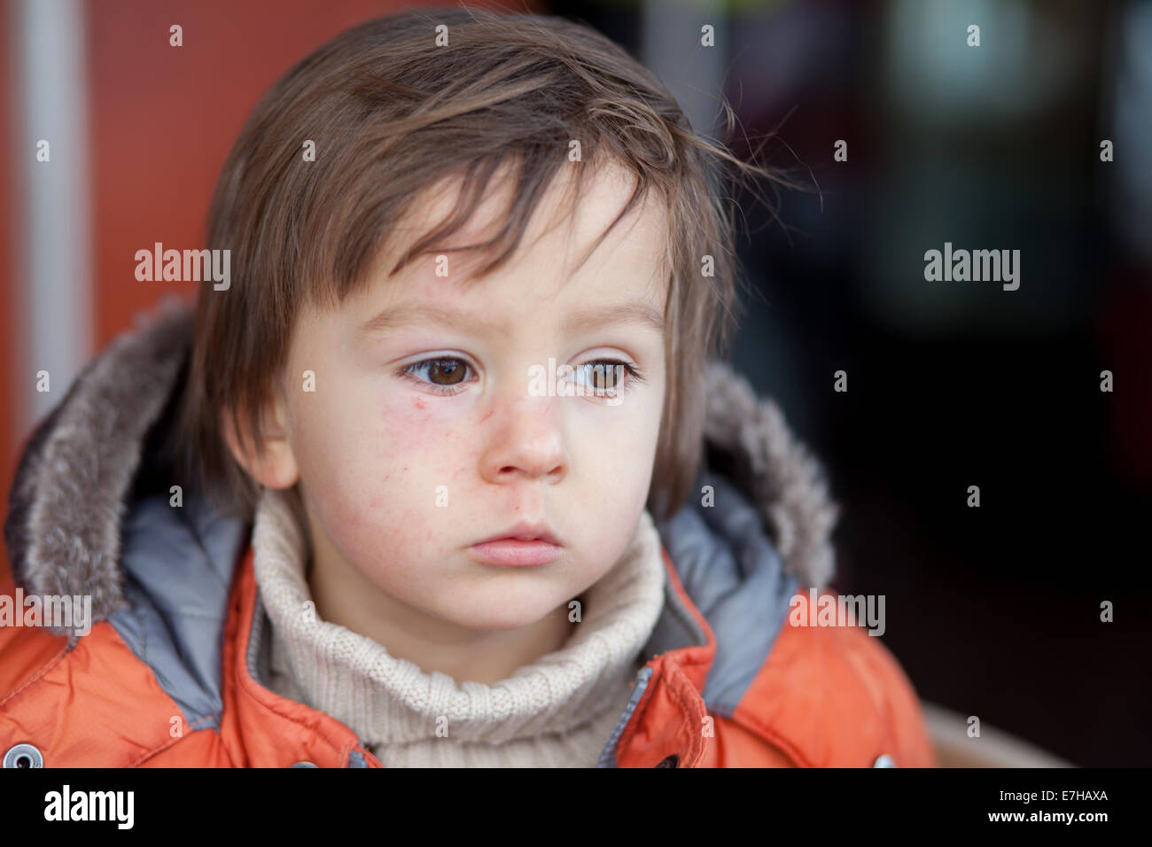 Boy with scratched face Stock Photo Alamy
