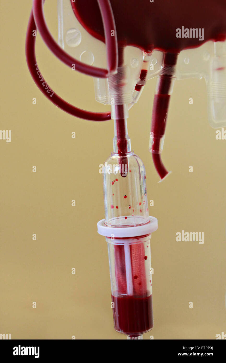 Blood transfusion bag 1 September 2014 Stock Photo Alamy