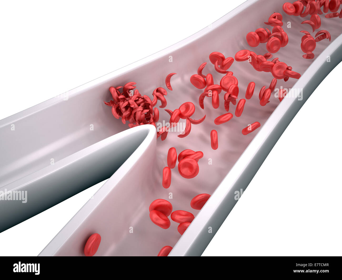 Sickle Cells Blocking Blood Flow - isolated on white Stock Photo