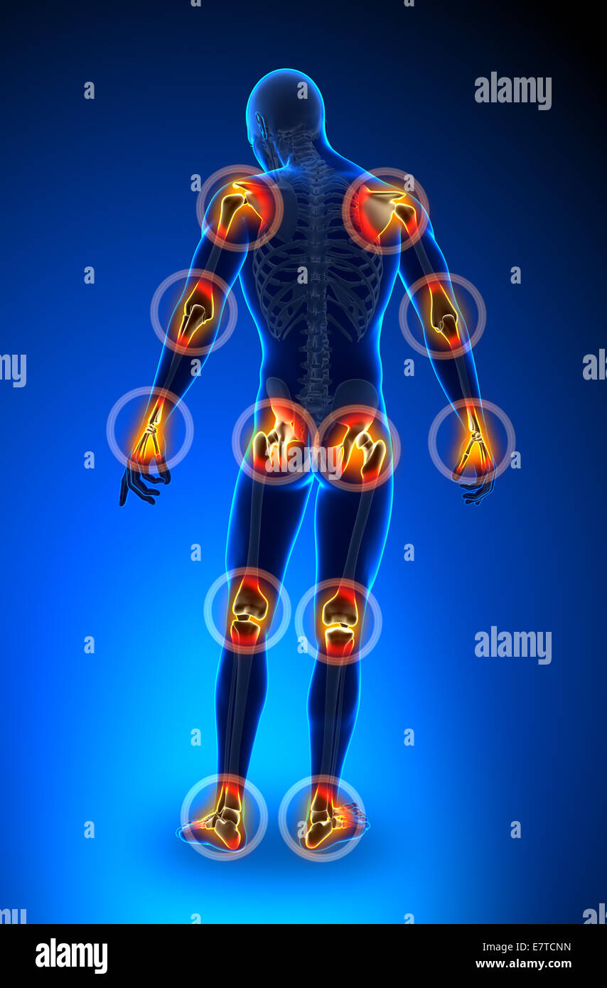 Joints pain full figure Arthritis Stock Photo Alamy