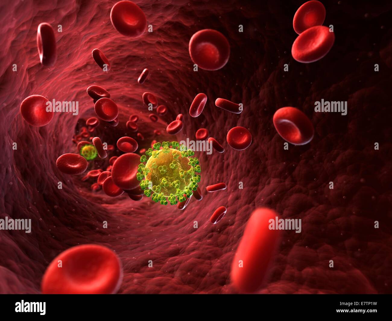 HIV (human immunodeficiency virus) infection, computer artwork. Stock Photo