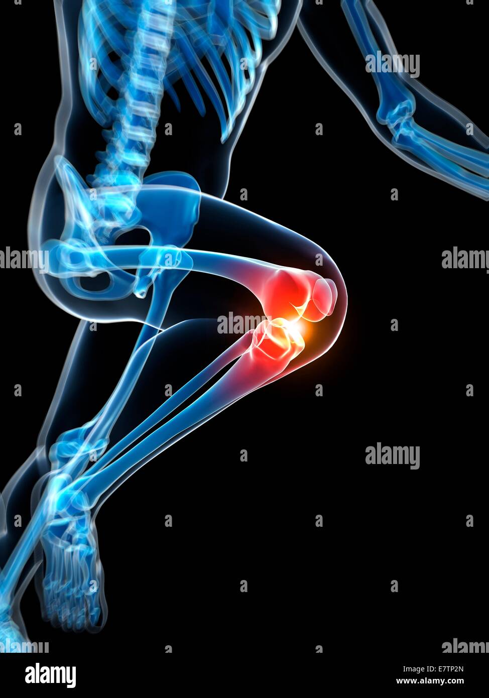 Human anatomy of a runner's knee joint, computer artwork Stock Photo