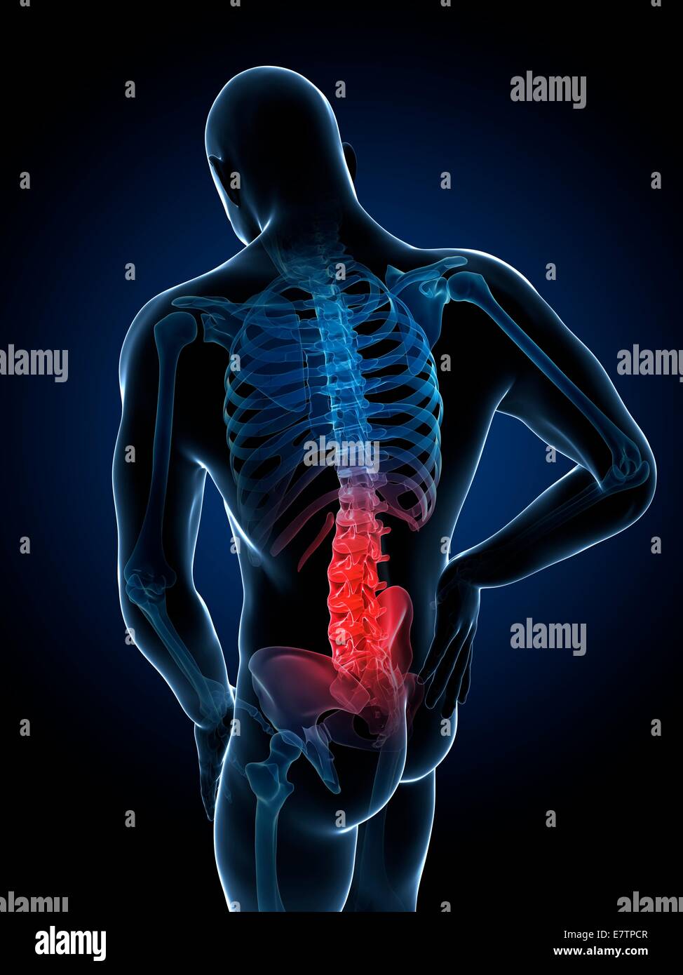 Human back pain, computer artwork Stock Photo - Alamy