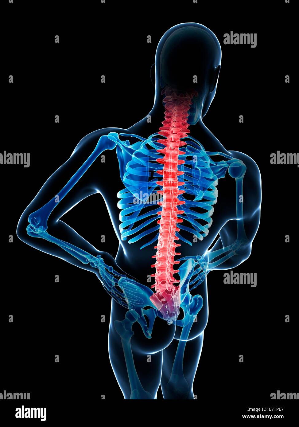 Human back pain computer artwork Stock Photo Alamy