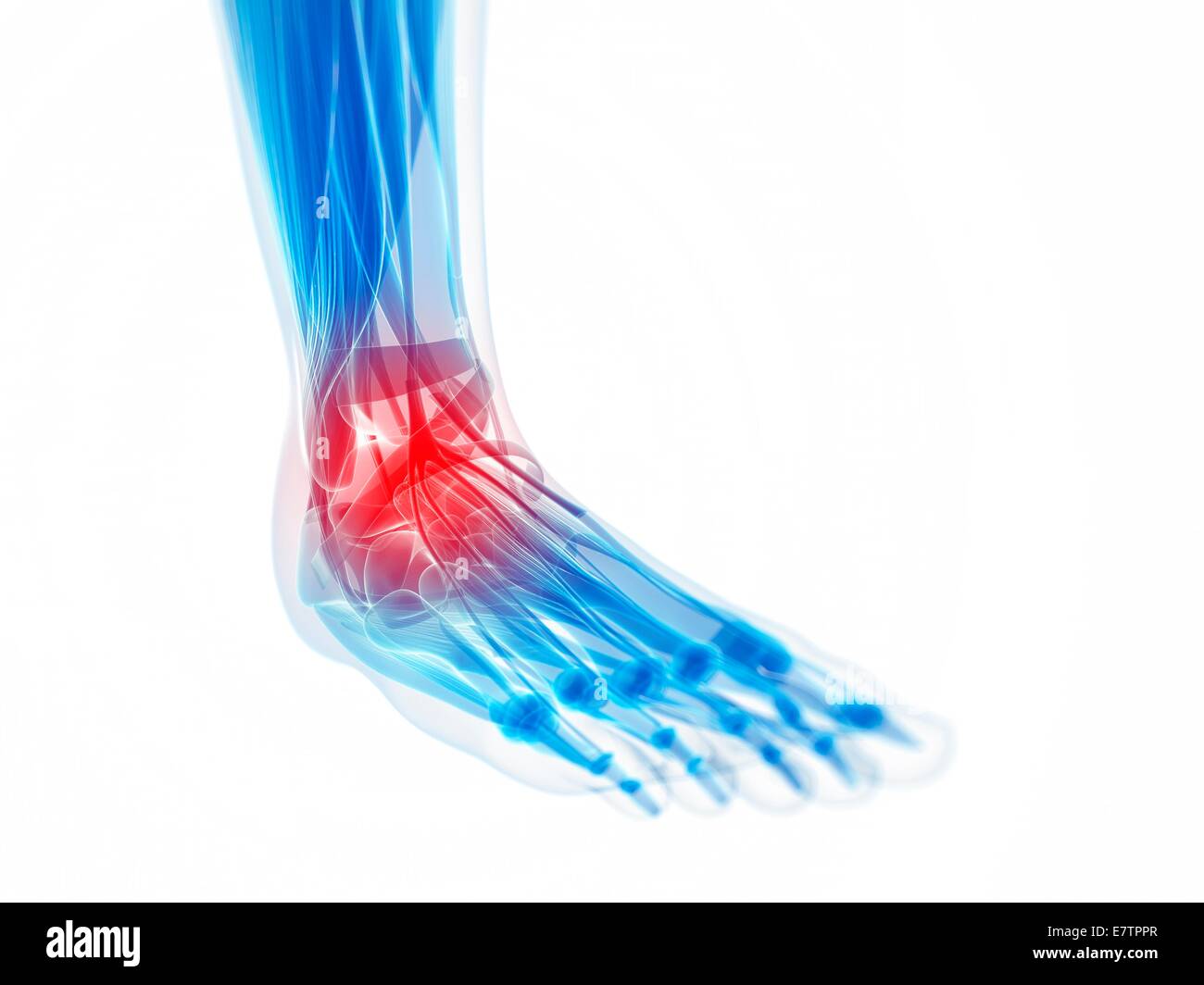 Human ankle pain, computer artwork Stock Photo - Alamy