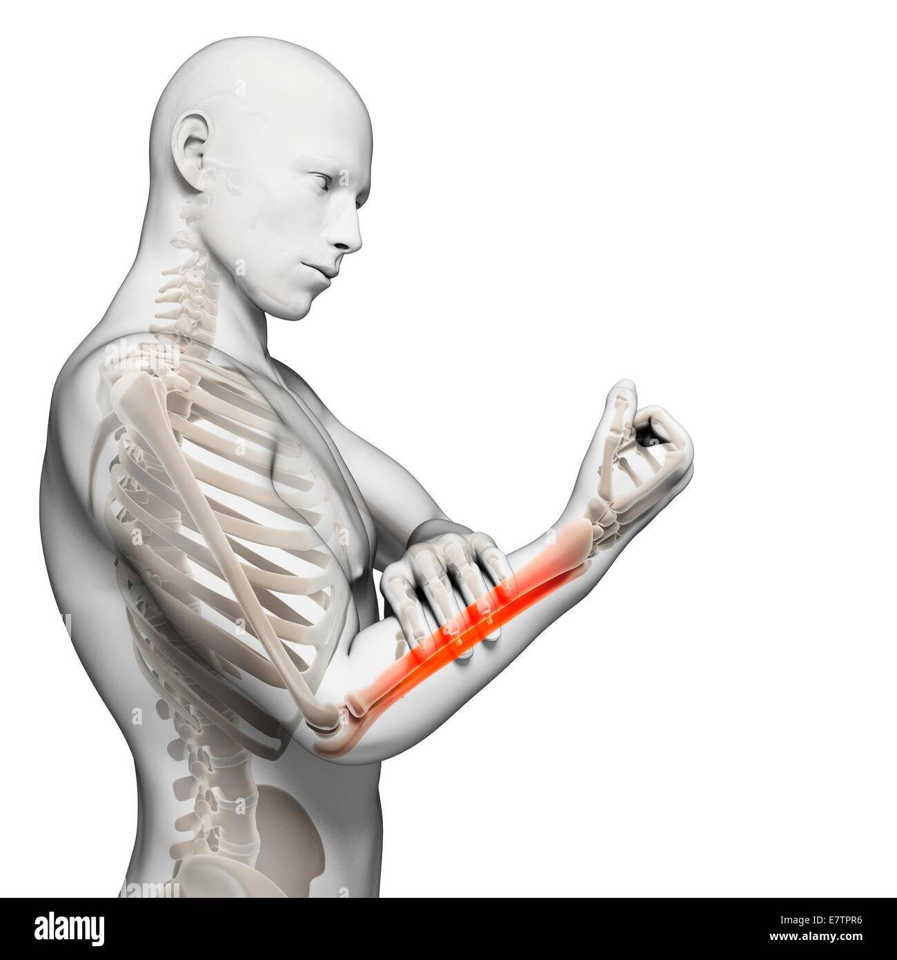 Human arm pain, computer artwork Stock Photo Alamy