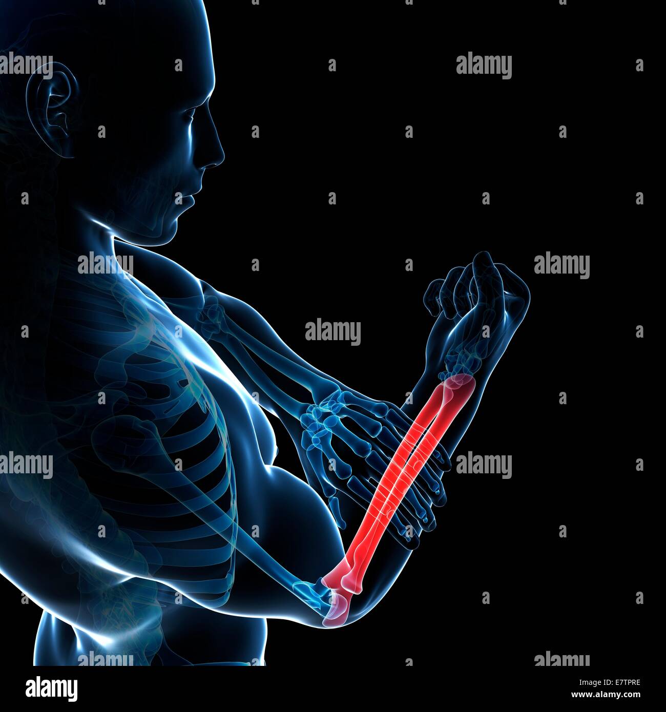 Human arm pain, computer artwork Stock Photo Alamy