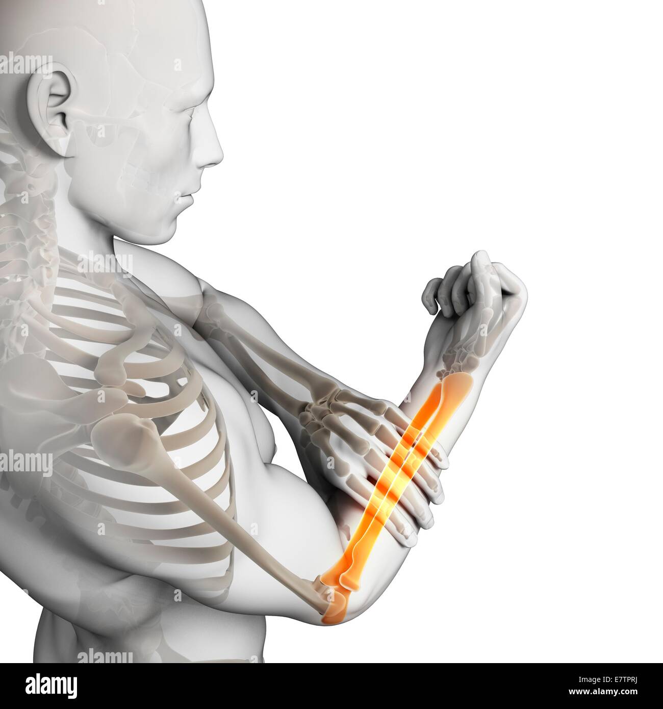Human arm pain, computer artwork Stock Photo Alamy