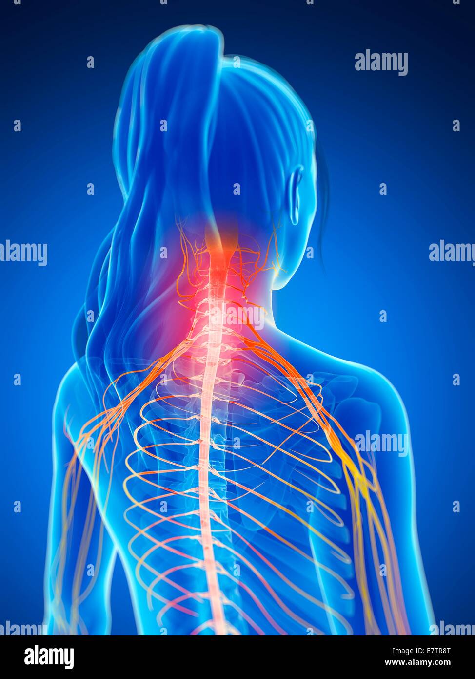 Human neck pain, computer artwork. Stock Photo