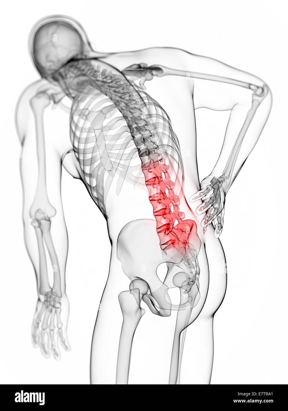 Human back pain, computer artwork Stock Photo - Alamy