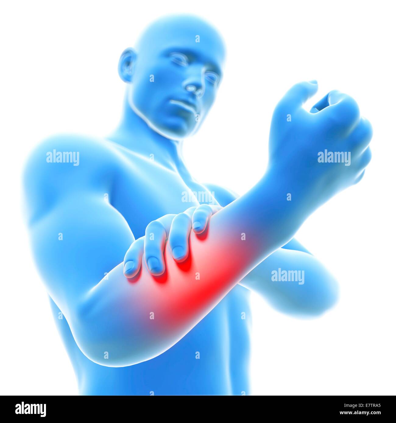 Human arm pain, computer artwork Stock Photo Alamy