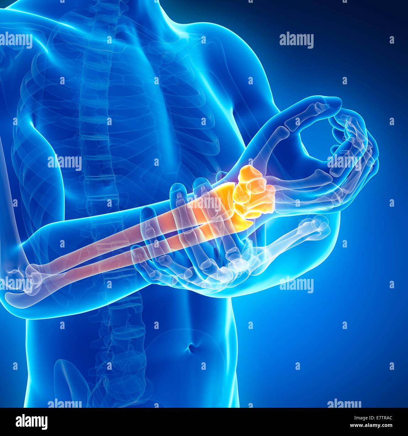 Human arm pain, computer artwork Stock Photo Alamy