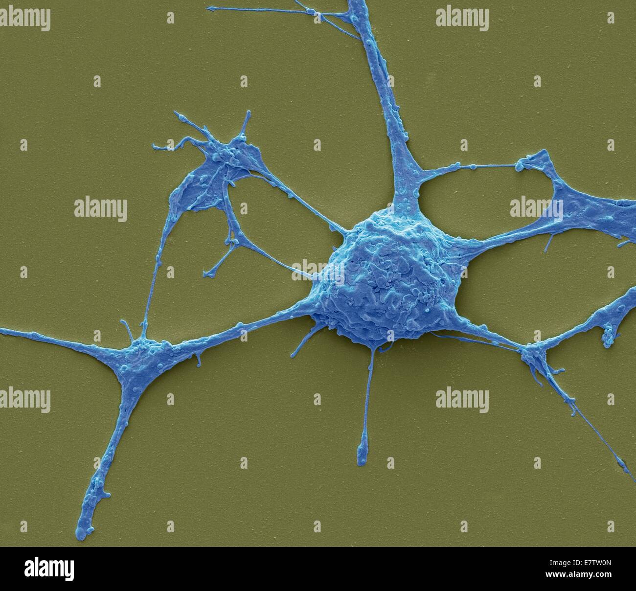 Neurone. Scanning electron micrograph (SEM) of a PC12 neurone in culture.The PC12 cell line, developed from a pheochromocytoma tumor of the rat adrenal medulla, has become a premiere model for the study of neuronal differentiation. When treated in culture Stock Photo