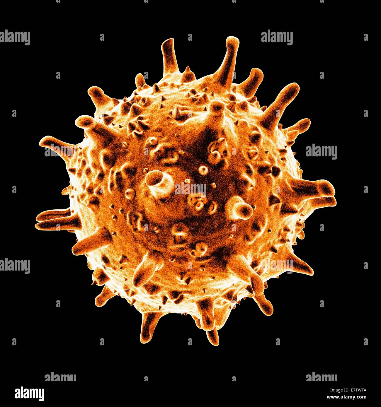 Sars Picture Example Severe acute respiratory syndrome (SARS), computer artwork Stock Photo ...