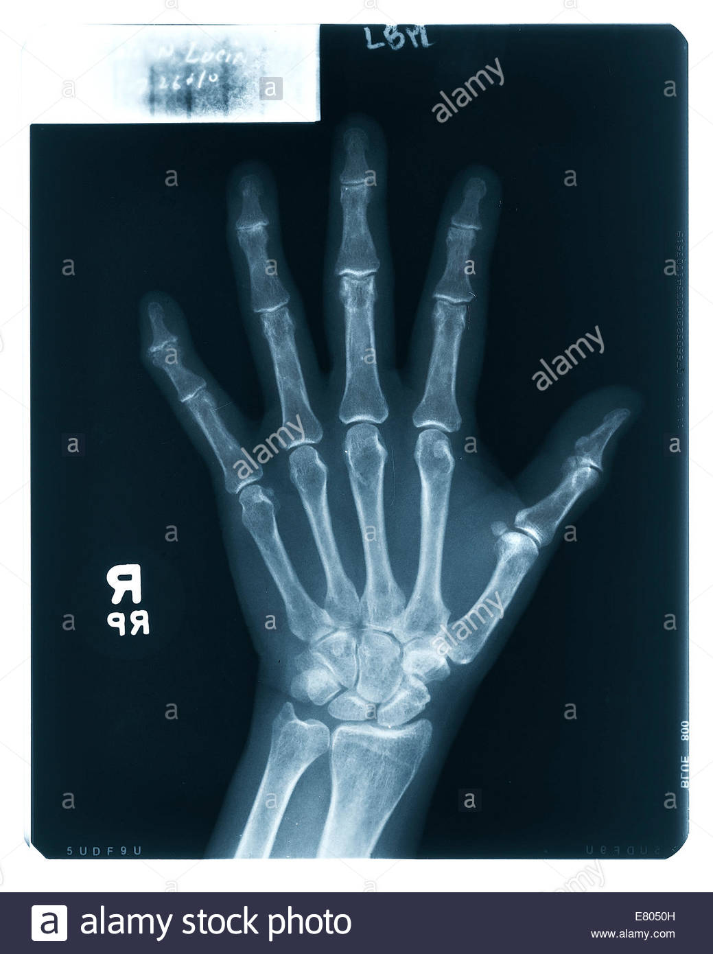 Finger Joint Stock Photos & Finger Joint Stock Images Alamy