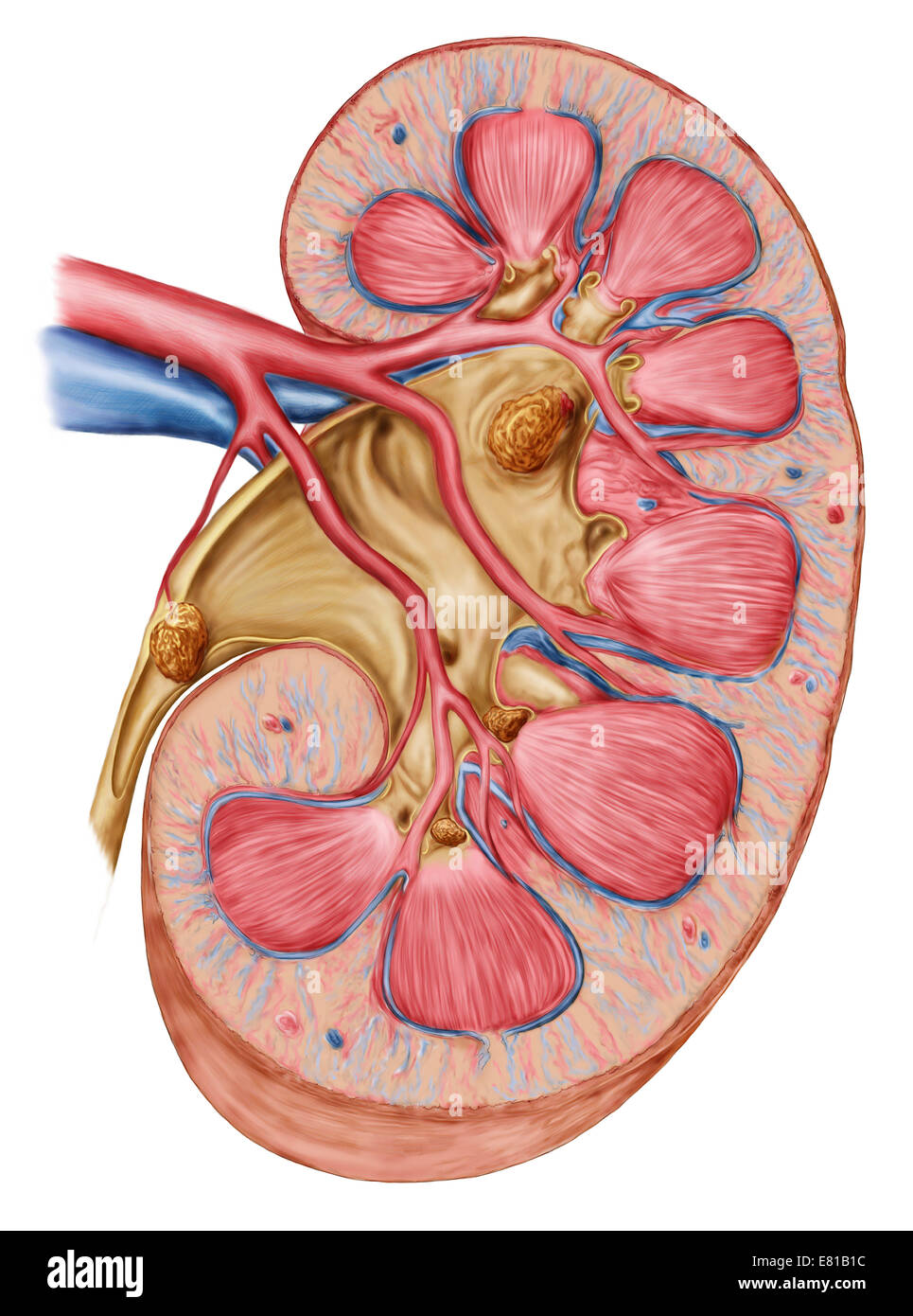 Staghorn calculus medical term - denseries
