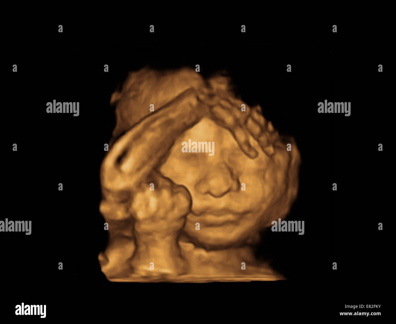 Foetus Face Coloured 3 D Ultrasound Scan Of A Foetus Gestational Age 24 Weeks And 2 Days Stock Photo Alamy