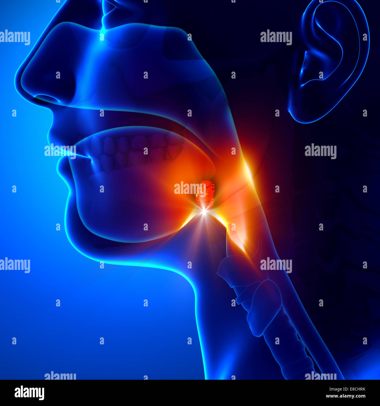 Tonsils Angina Pectoris Stock Photo Alamy